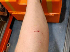 В Луганске собаки напали на девушку