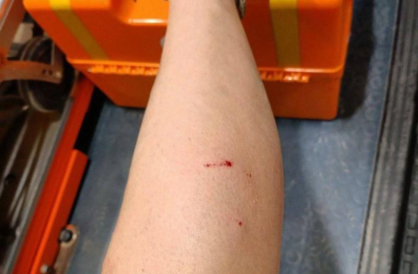 В Луганске собаки напали на девушку