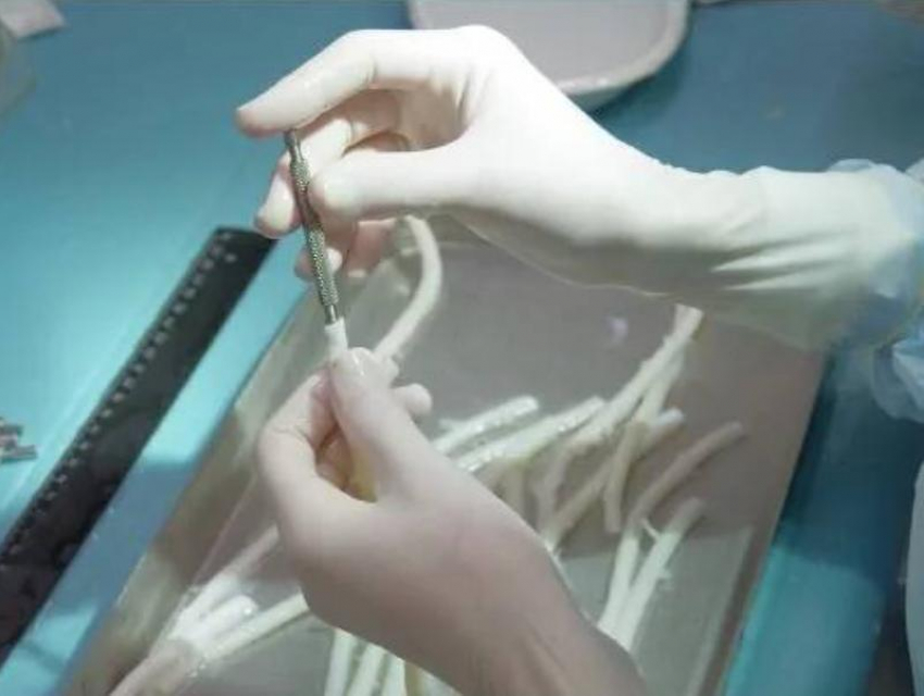 В клиники ЛНР доставили уникальные биологические протезы  