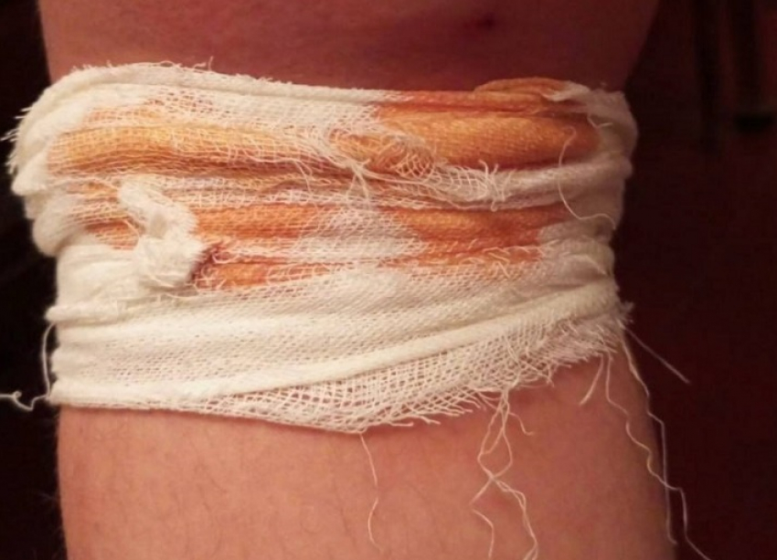 Следователи проверяют случай с нападением бездомных собак на школьницу в Алчевске